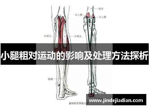 小腿粗对运动的影响及处理方法探析